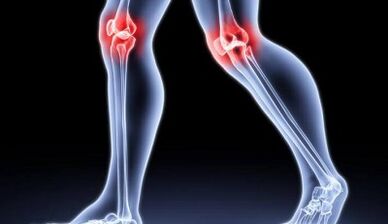 Prävention von Arthritis und Arthroseentwicklung