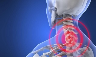 Ursachen der zervikalen Osteochondrose
