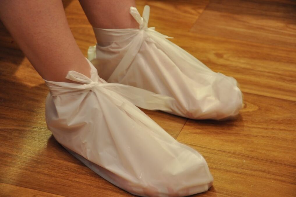 Kompressen bei Knöchelarthrose