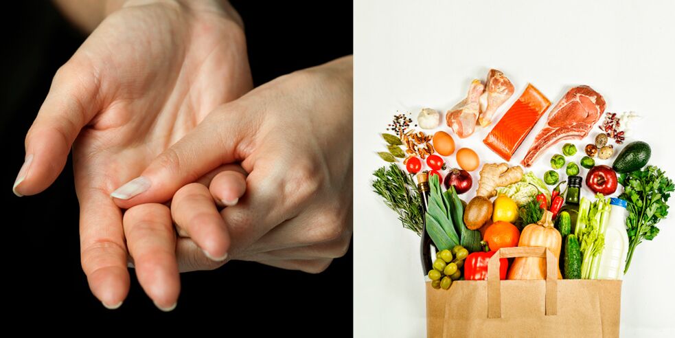 Gichtarthritis der Hände und Nahrung, um sie zu behandeln